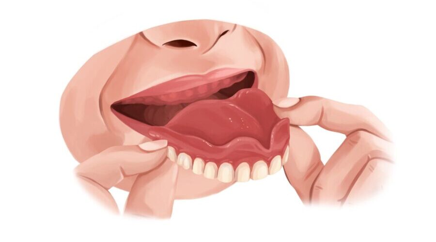 Illustration of a woman taking her full dentures out